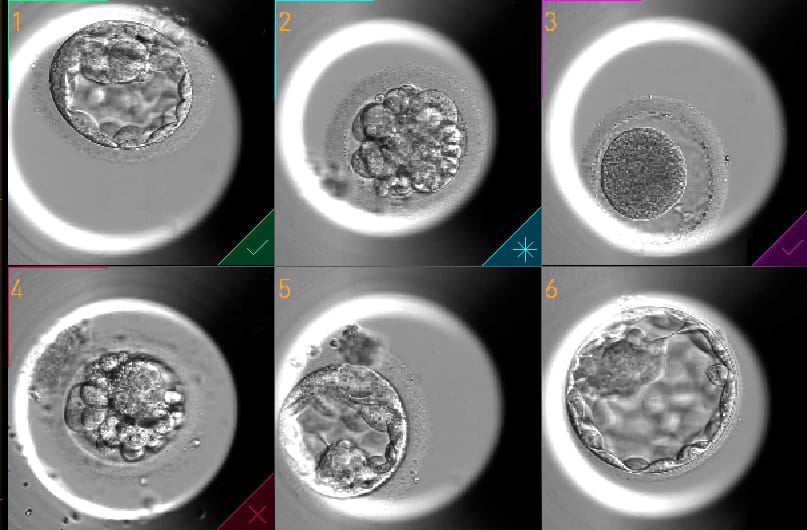 Capa: Tecnologia de última geração integrada à inteligência artificial traz avanços a tratamentos de Fertilização in Vitro